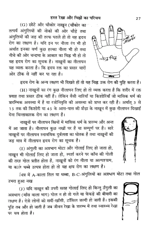 Hasta Rekha Dvara Roga Jnana Evam Nidana